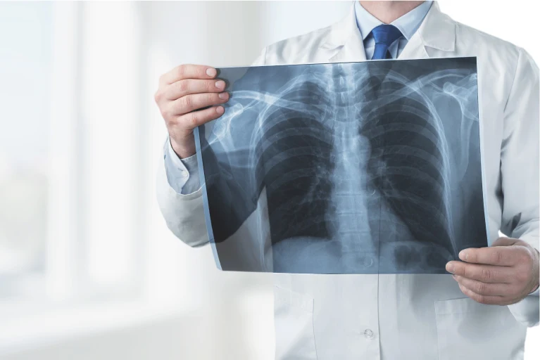 Asma, EPOC y Fibrosis Quística