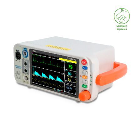 Monitor de signos vitales